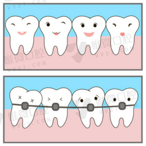 *根尖周炎患牙在建立了通畅的（导致根尖周炎的主要感染途径是）(图1)